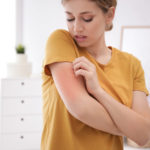 How to Cater to Your Eczema During The Winter