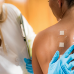 Metal Allergy Testing: How It Works and What To Expect